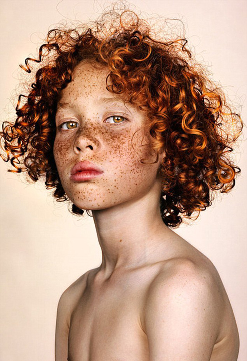 英摄影师为雀斑人群打造视觉盛宴_海外动态
