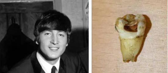 约翰·列侬的牙齿