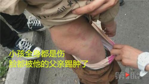 显然,新闻事件中的这位父亲,以不听话为由,对孩子拳打脚踢已经触犯