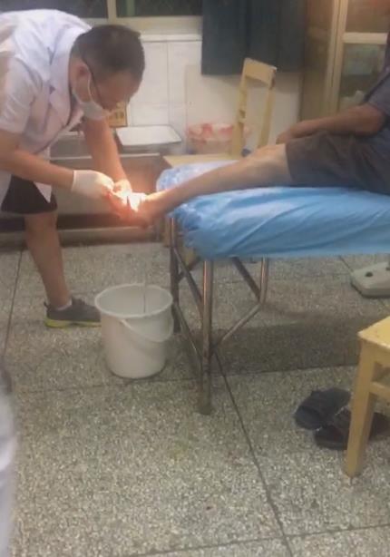 李江门脚掌被弄出血,医生正在为其治疗。