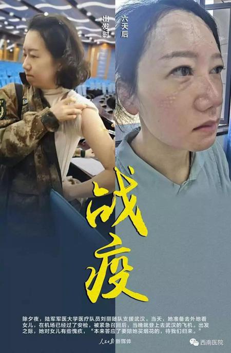 刘丽的对比照感动无数网友 西南医院供图