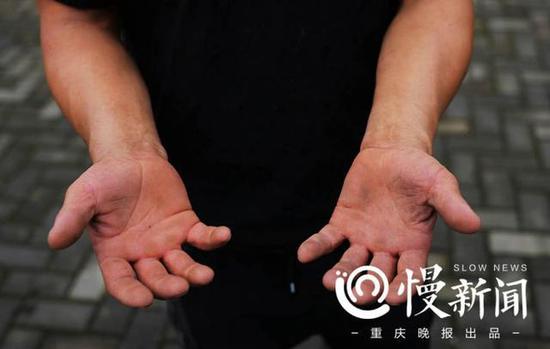 谢凤国的手上已经磨出老茧