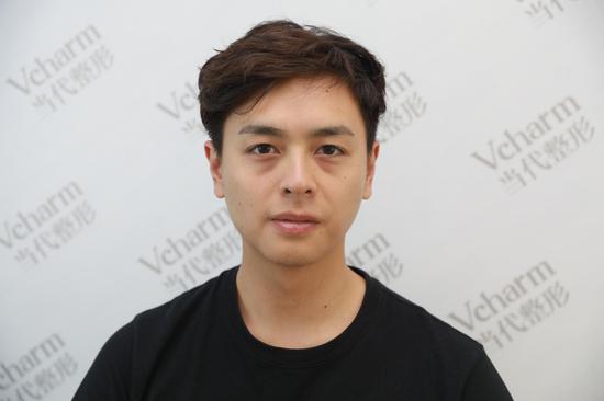 黄迦迪术前照片