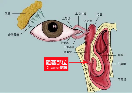 泪液排除系统