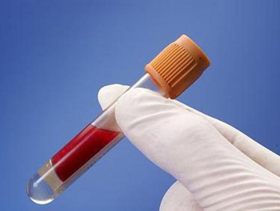 一文看懂 乙肝通过什么传染?