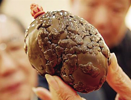 鸡肚子里竟取出两个宝贝 市民打飞的到上海鉴