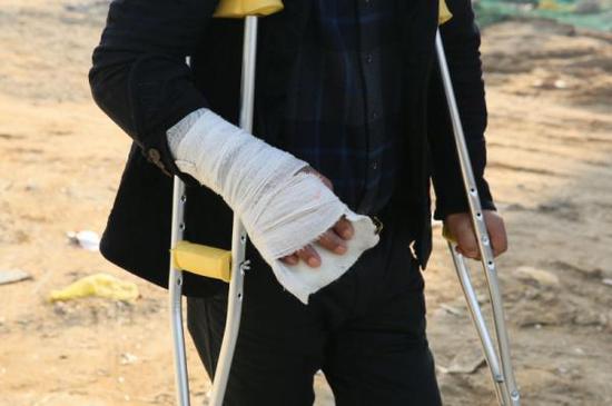 赵家友被打,左下肢外伤,左腓骨多段骨折,右手外伤,右手第4掌骨基底骨折,枕骨骨折。