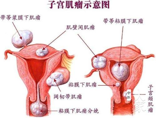 上环高清图片