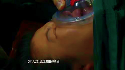 广东脐带脱垂的孕妇在进行无麻醉剖宫产手术