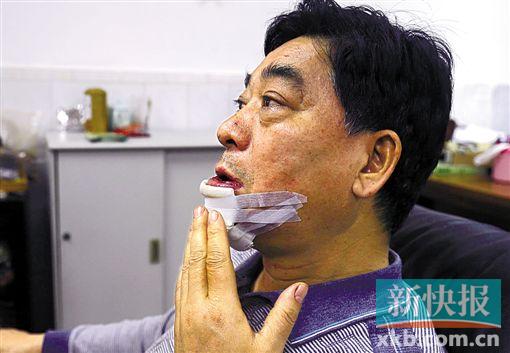 ■老王因为这个沙井栽倒在地,缝了13针。新快报记者 毕志毅/摄