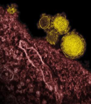 MERS-CoV 来源 WHO revises MERS-CoV surveillance advice