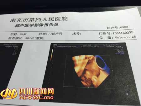 胎儿有遗传畸形?南充孕妇两家医院孕检结果大