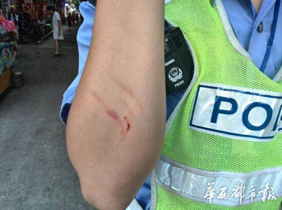 四川女司机驾车逆行挠伤交警 被拘留5天