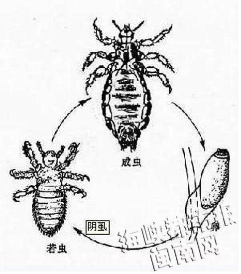 女童眼睫毛长20只阴虱 医生：不注重卫生所致