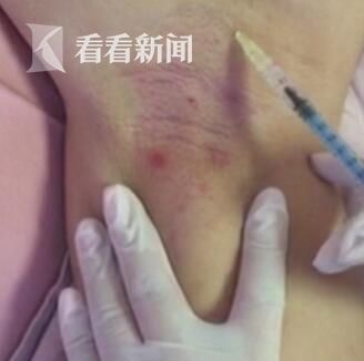 亿同看0/1.win2022