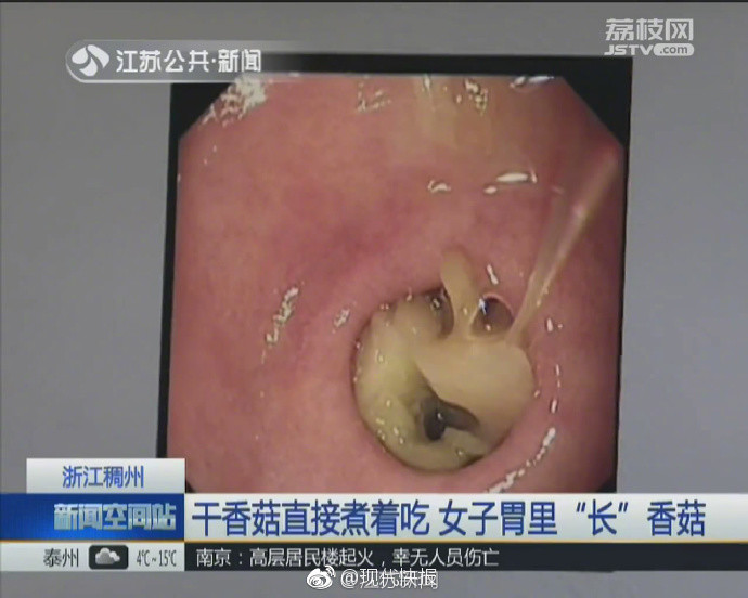 男人捅女人肌肌