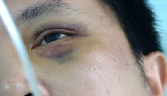 羞羞视频