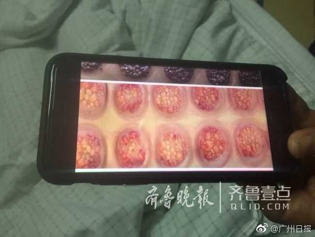 俄罗期浓毛BBX X