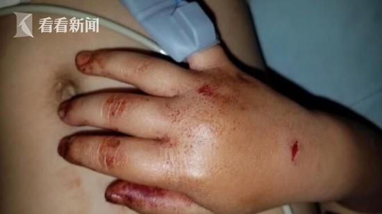 德国美女