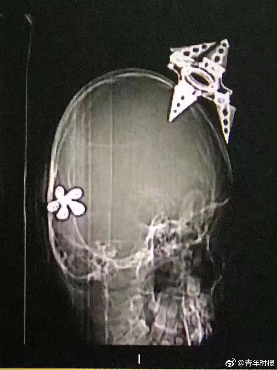 黄色网站视频在线观看