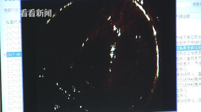 牛奶浴