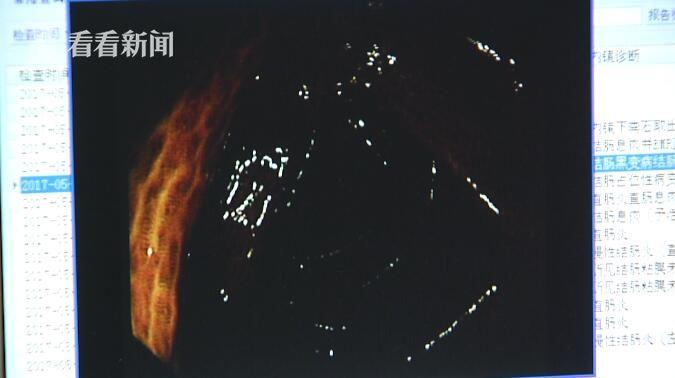 狼友视频在线