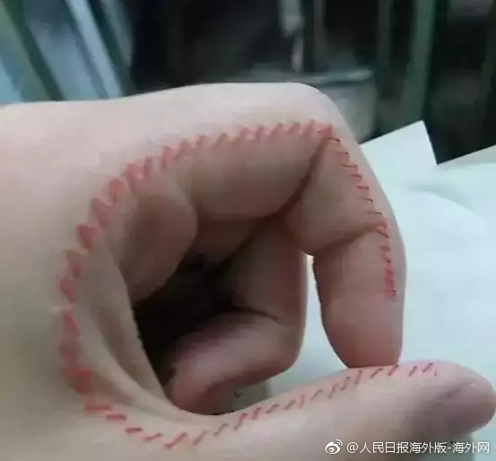 大陰唇毛茸茸黑森林