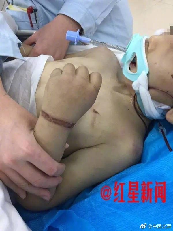 四虎黄片