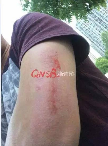 秘 成人羞羞视频网站