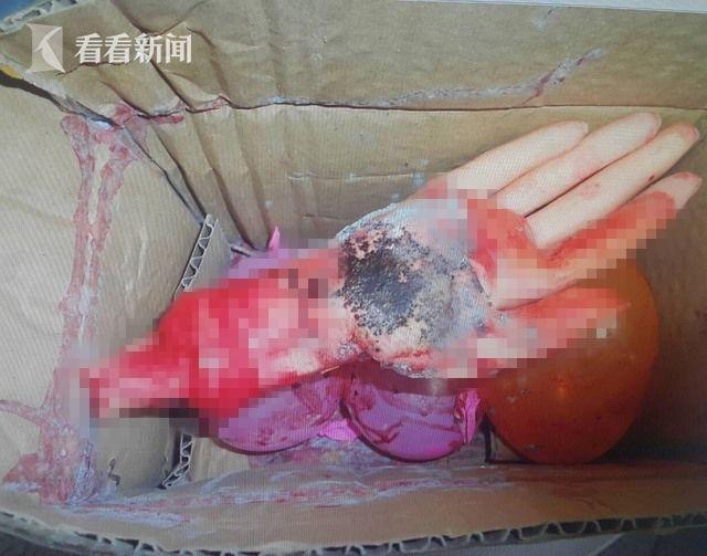 病毒