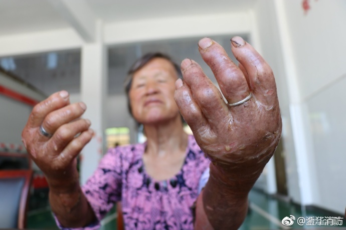 樱桃视频污