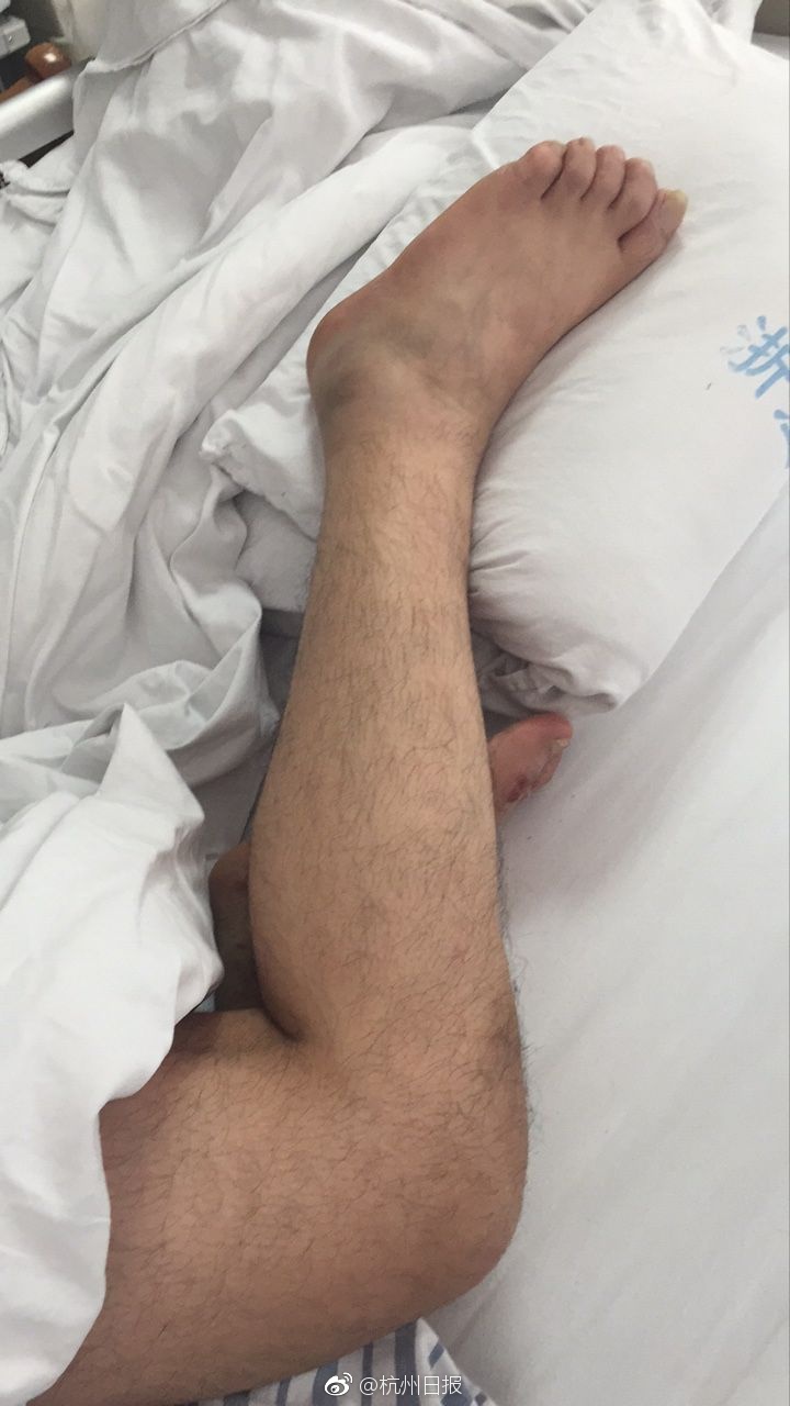 又疼又叫直播软件下载安装