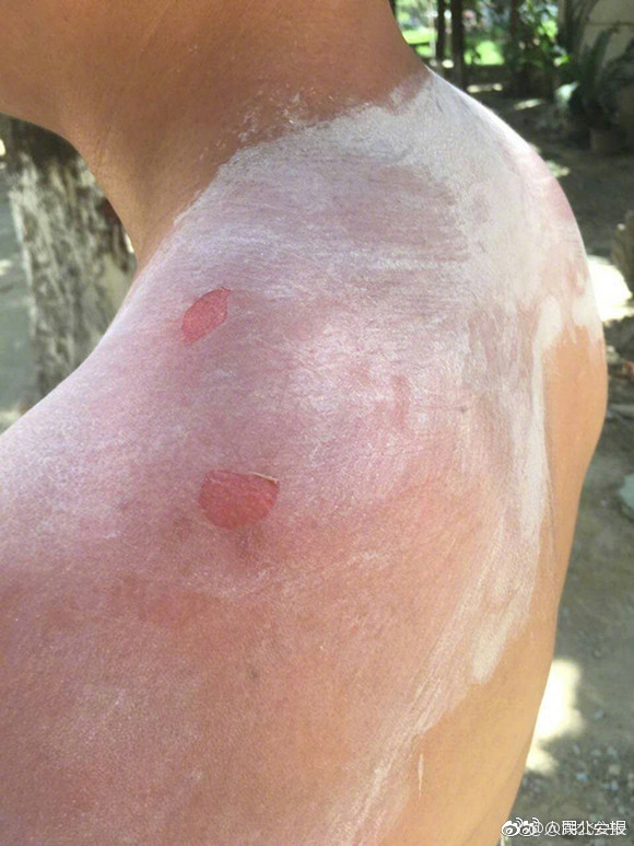 佐山愛