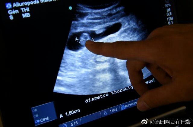 成人 戏