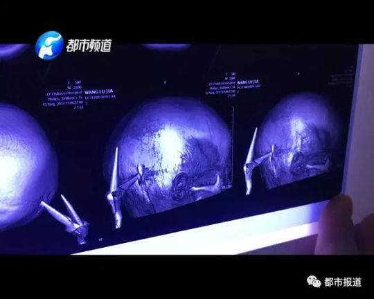 他撕开我奶罩揉吮我奶头A片