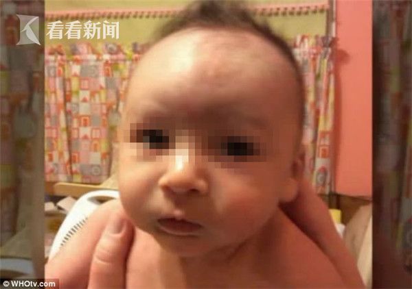 拔陰毛