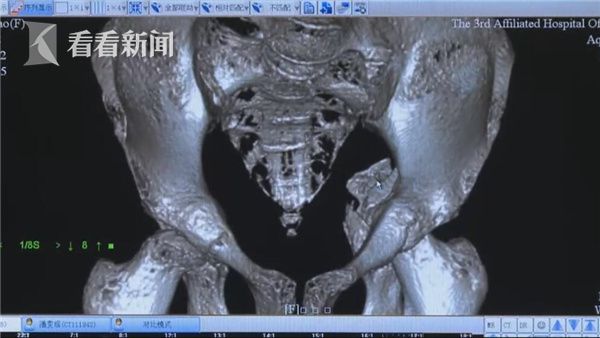 麻豆传媒直播APP
