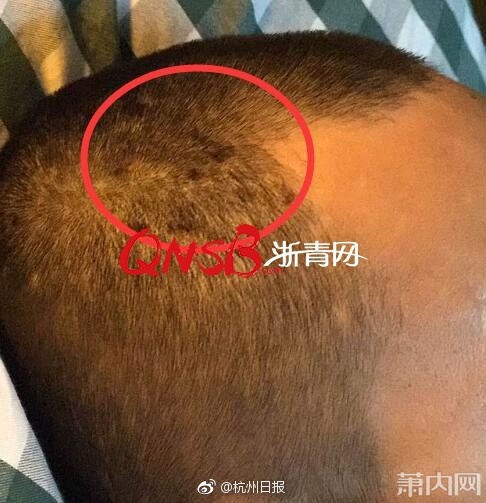 台灣街頭走光