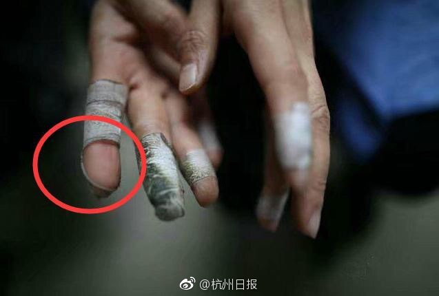 金善英
