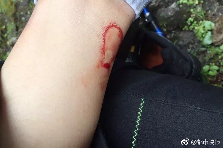男人的 伸到 屁股里运