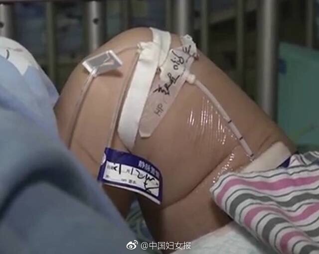 乳房打钉子Sm性及虐