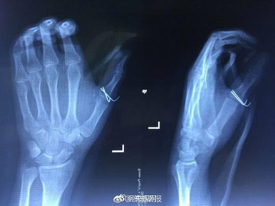 台湾老黄片