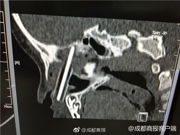 Chinasexsex熟女裸体
