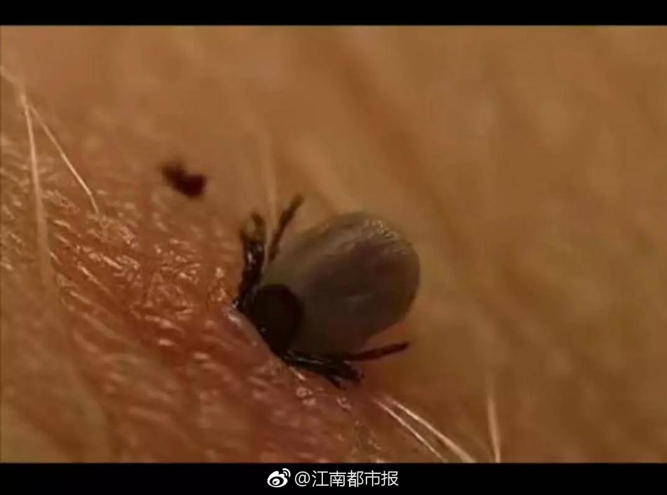 偷拍按摩的老女人Chinese