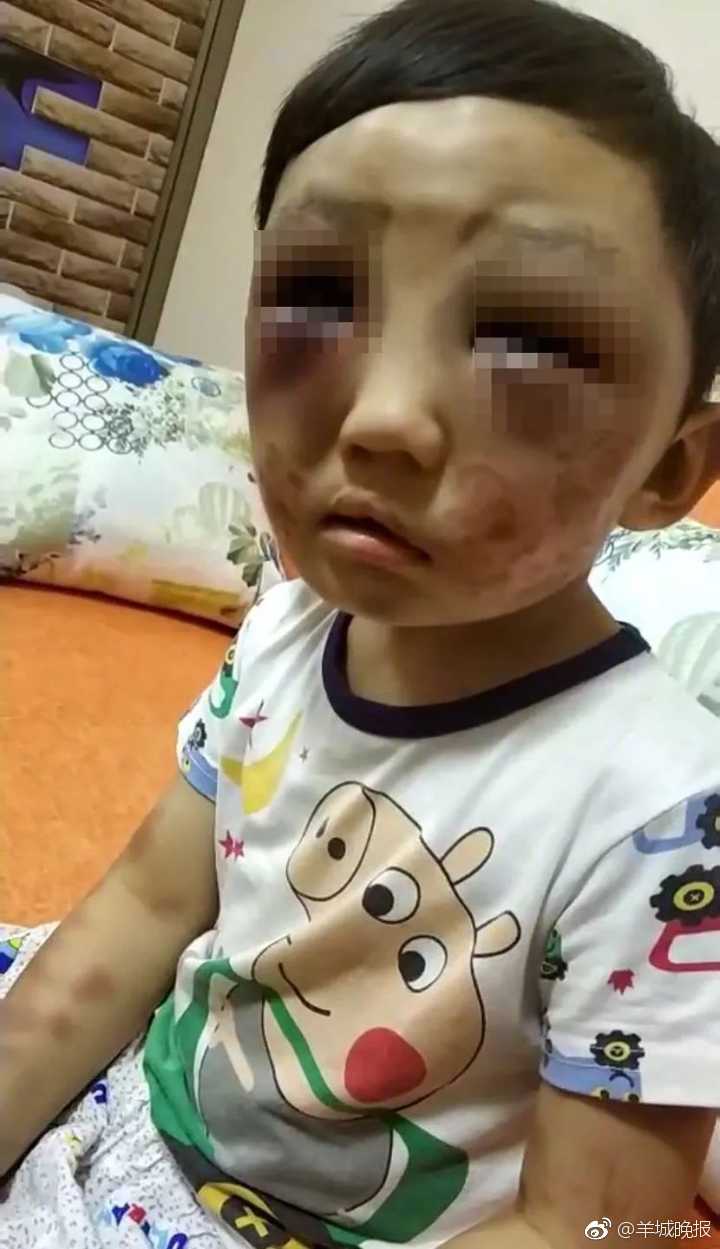 暗网