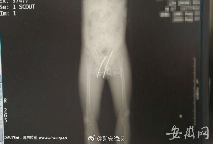 特级黄片三级片
