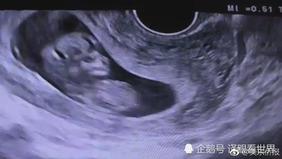 国产熟女三个东北女人