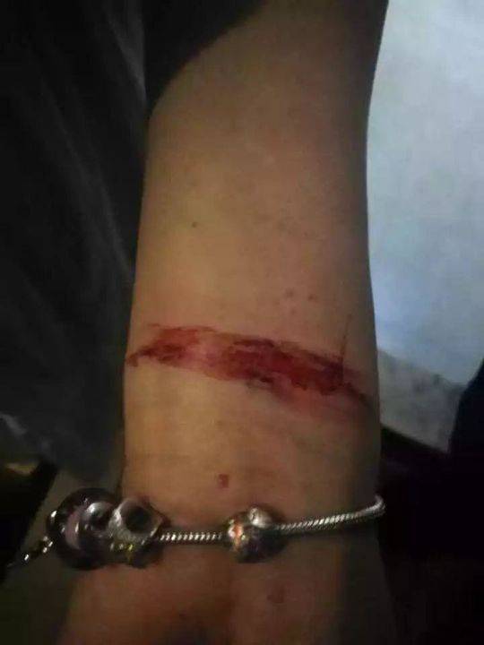女人扒开腿秘 打扑克动