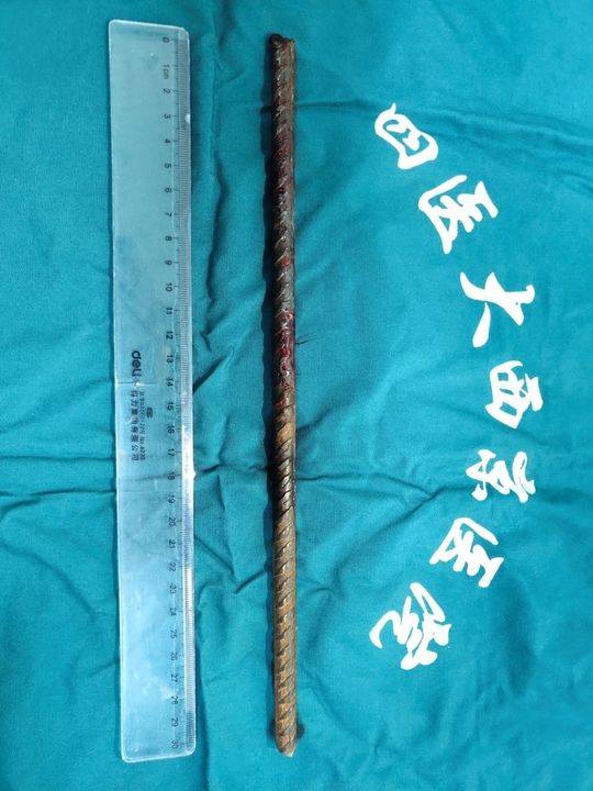神经外科_神经外科收入