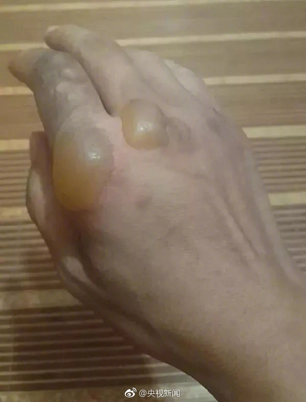 永久越南女三级片免费观看完整版